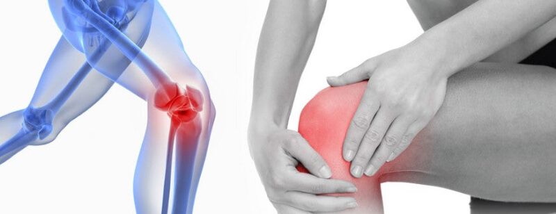 Knee_Pain (3) (1).jpg
