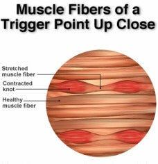Muscle_Knots (1).jpg